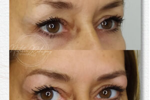beautyis microblading de cejas_06 beautyis microblading de cejas_06