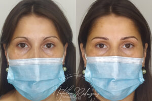 beautyis microblading de cejas_07 beautyis microblading de cejas_07