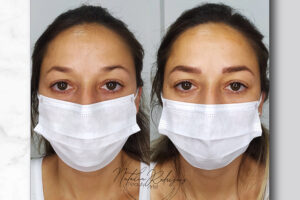 beautyis microblading de cejas_08 beautyis microblading de cejas_08