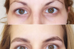 beautyis recuperación de cejas_02 beautyis recuperación de cejas_02