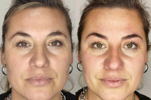 beautyis microblading de cejas_15 beautyis microblading de cejas_15