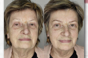 beautyis microblading de cejas_20 beautyis microblading de cejas_20