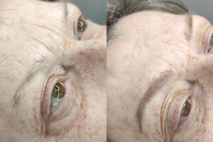 beautyis microblading de cejas_21 beautyis microblading de cejas_21