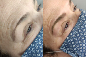 beautyis microblading de cejas_23 beautyis microblading de cejas_23