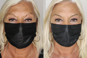 beautyis microblading de cejas_30 beautyis microblading de cejas_30