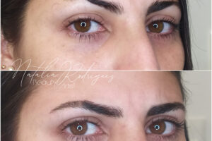 beautyis micropigmentación de cejas con dermógrafo_01